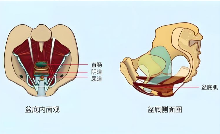 盆底康复有必要做吗？产后松弛漏尿别再踩坑！
