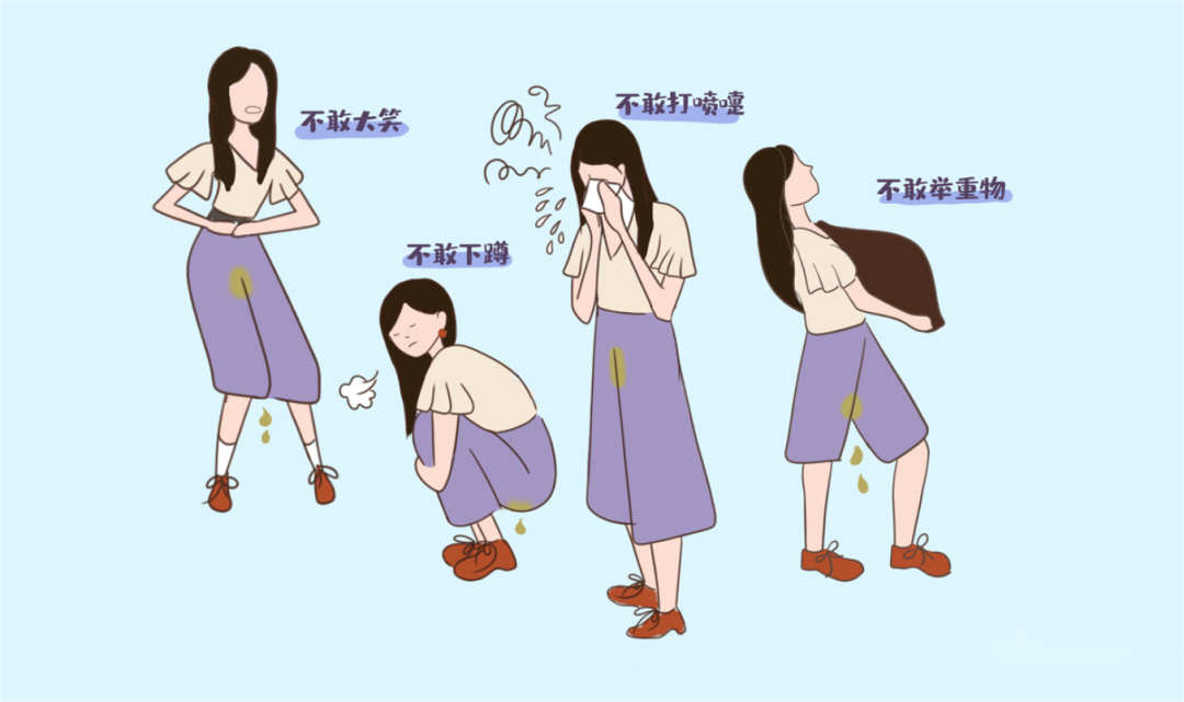 一文快速自查：怎么判断你是漏尿，还是盆腔脱垂？